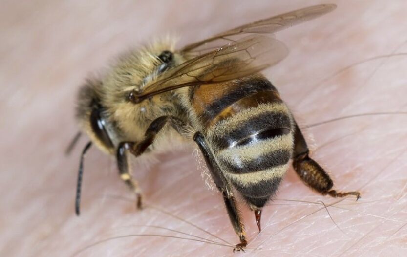 陰茎の拡大のための蜂の刺し傷